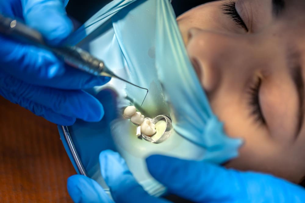 Resinas estéticas en Villahermosa: Restauración dental natural y funcional