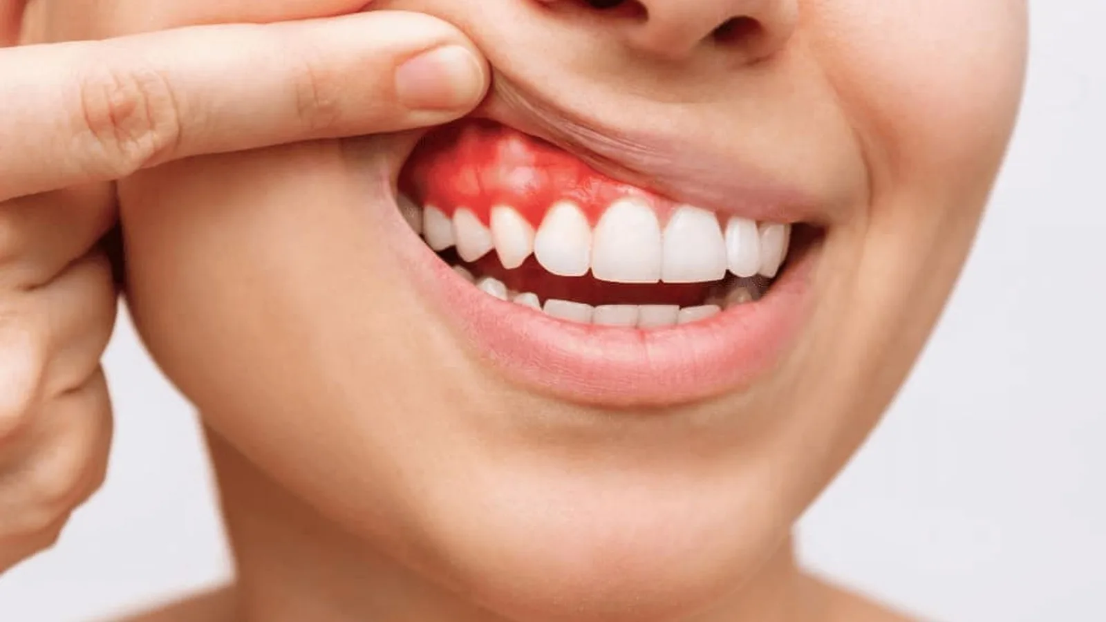 Endodoncista vs especialista en rehabilitación oral: ¿A quién acudir en Villahermosa?